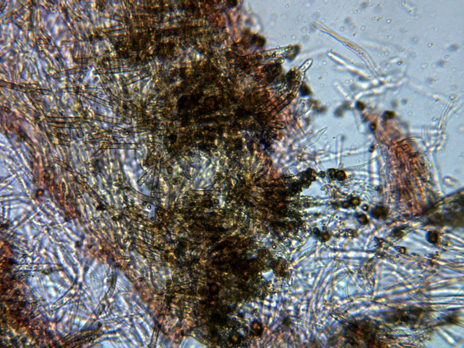 Microscopía de Trichopeziza subsulphurea - 13 - Pelos marginales x 400
